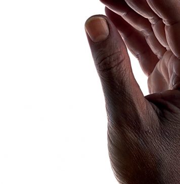 Lesson of the Day: ‘Discussing Blackness on Reddit? Photograph Your Forearm First’ Lesson of the Day: ‘Discussing Blackness on Reddit? Photograph Your Forearm First’