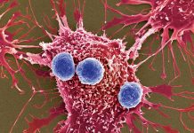 A New Cancer Treatment That Is Faster, More Efficient and Less Risky Is Coming: Bacteria Bombs A New Cancer Treatment That Is Faster, More Efficient and Less Risky Is Coming: Bacteria Bombs