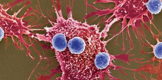 A New Cancer Treatment That Is Faster, More Efficient and Less Risky Is Coming: Bacteria Bombs A New Cancer Treatment That Is Faster, More Efficient and Less Risky Is Coming: Bacteria Bombs