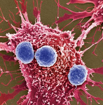 A New Cancer Treatment That Is Faster, More Efficient and Less Risky Is Coming: Bacteria Bombs A New Cancer Treatment That Is Faster, More Efficient and Less Risky Is Coming: Bacteria Bombs